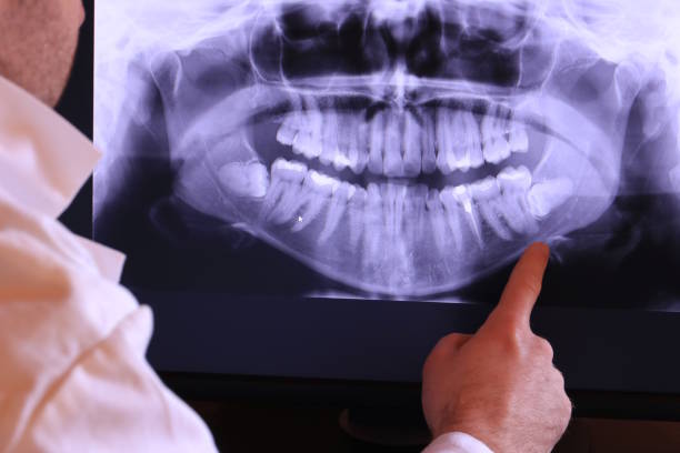 Best Cosmetic Emergency Dentistry in West University Place, TX