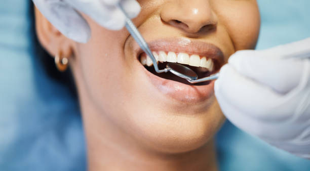 Best Emergency Dental Care for Broken or Chipped Teeth in West University Place, TX