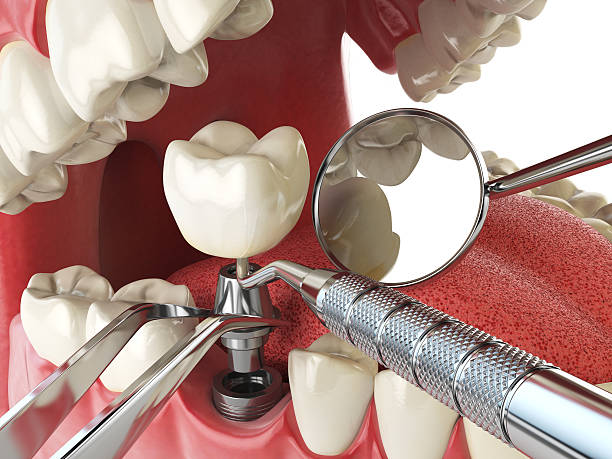 Best Emergency Gum Treatment in West University Place, TX
