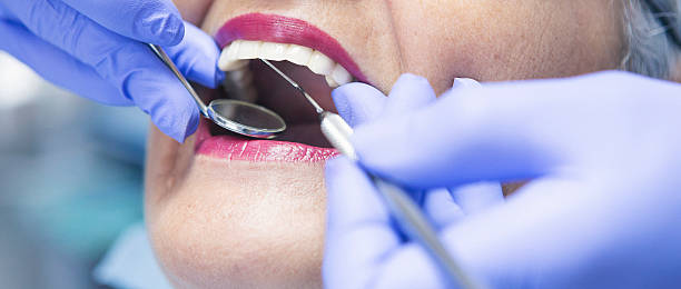 Best Urgent Care for Lost Fillings or Crowns in West University Place, TX