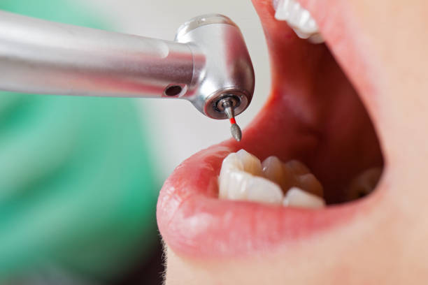 Best Pediatric Emergency Dentist in West University Place, TX